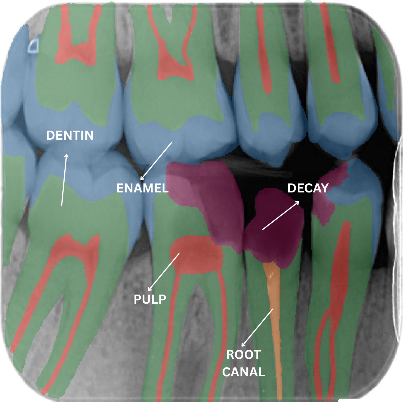 Annotated Dental X-ray
